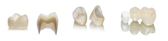 циркониевые коронки в стоматологии Апекс-Д