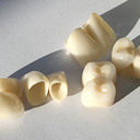 установка керамической коронки на зубы